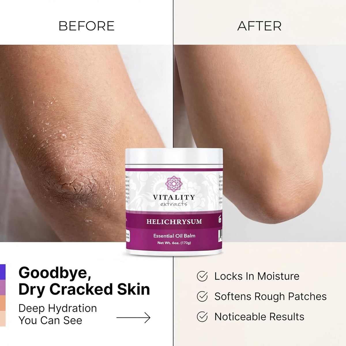 Vitality Extracts Helichrysum Balm - 6oz, Helichrysum Gymnocephalum, Beeswax, Almond Oil, Ultra-Moisturizing, Skin Healing, Full Body Hydration